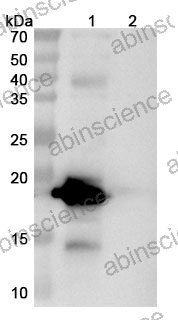Anti-Bet v 1/Allergen Bet v I-A Recombinant Antibody (SAA0667)