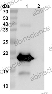 Anti-Bet v 1/Allergen Bet v I-A Recombinant Antibody (SAA0668)