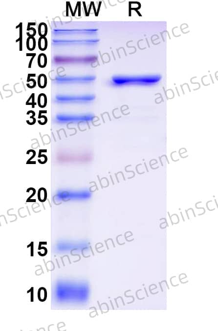 Rat AADAT Recombinant Protein (N-His)