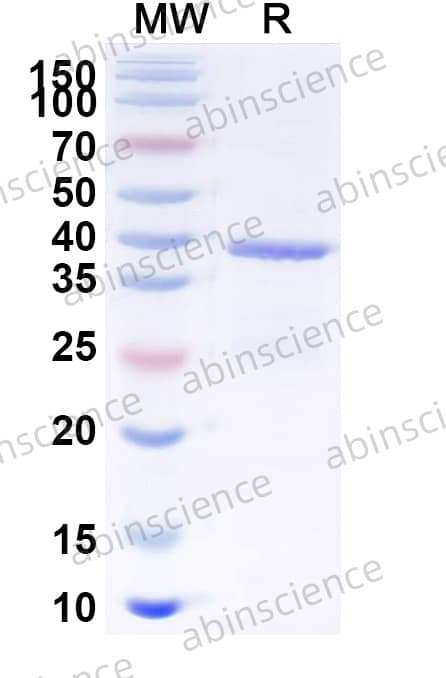 Rat RETNLA/FIZZ1 Recombinant Protein (C-Fc)