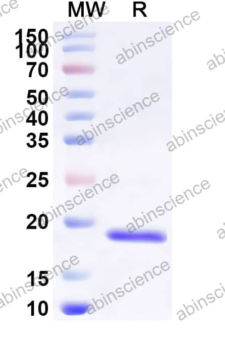 Rat IL-10 Recombinant Protein (N-His)
