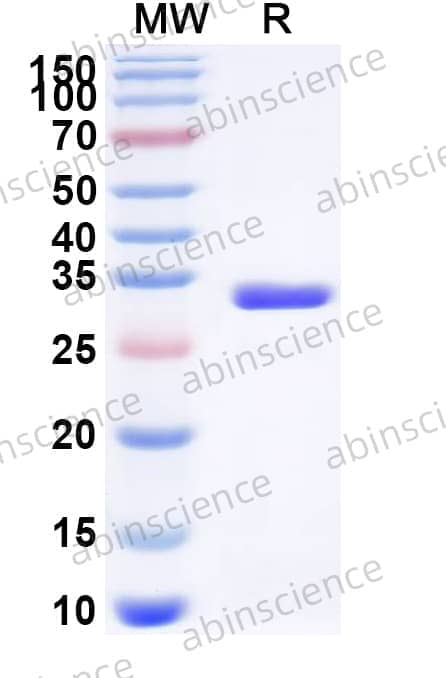 Rat CA2 Recombinant Protein (N-His)