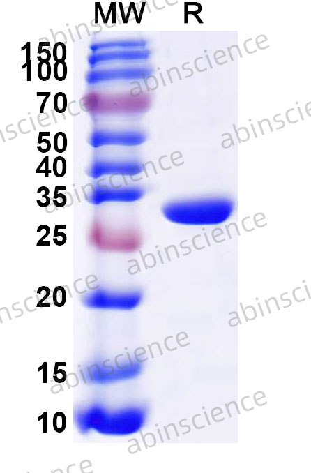 Rat SIRT3 Recombinant Protein (N-His)