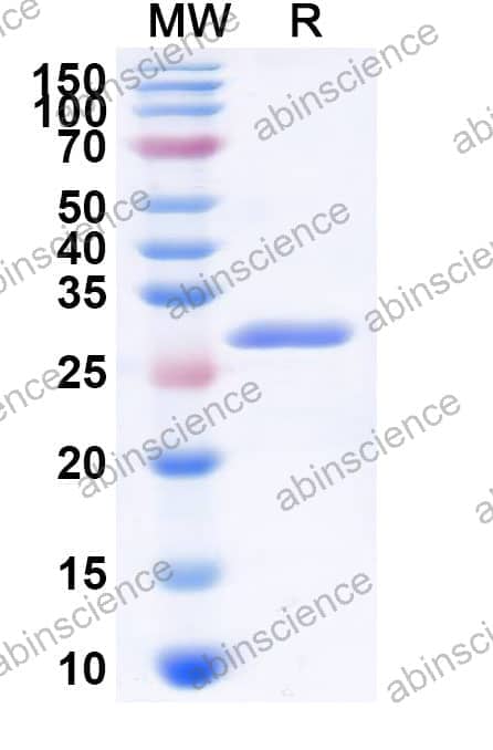Rat PIEZO1 Recombinant Protein (N-His)