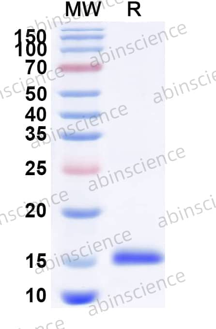 Rat SLC22A6 Recombinant Protein (N-His)