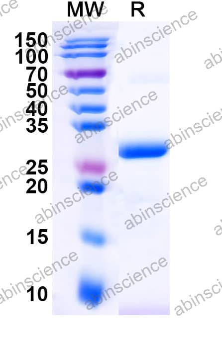 Rat ANGPT2/Ang2 Recombinant Protein (N-His)