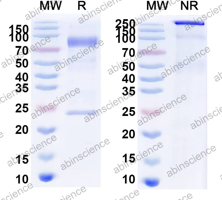 Rat IgE Isotype Control antibody (SPE-7)