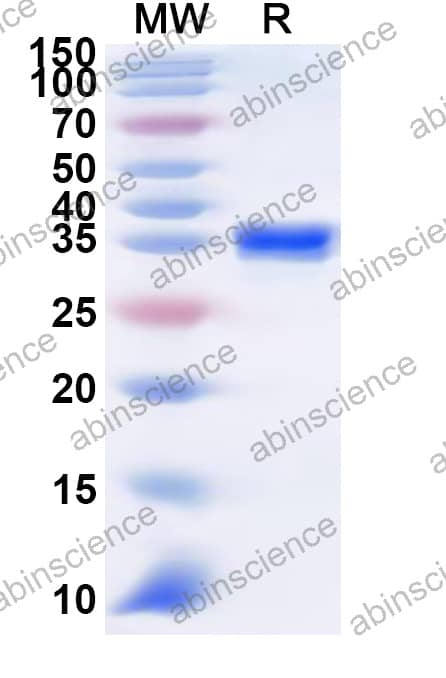 Rat NRG4 Recombinant Protein (N-GST & C-His)