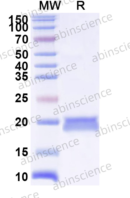 Rat NSF Recombinant Protein (N-His)