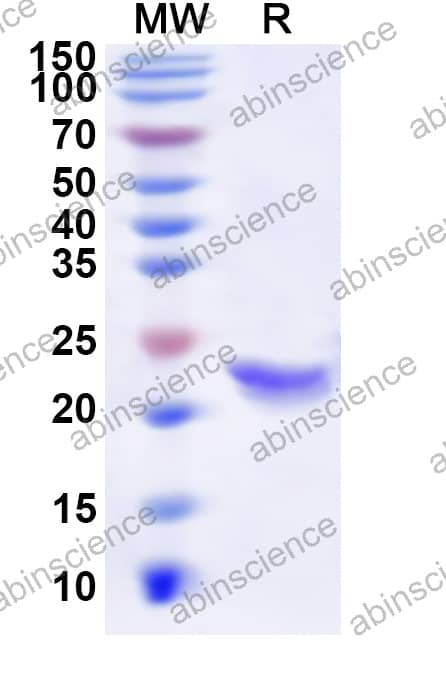 Rat LCN2 Recombinant Protein (N-His)