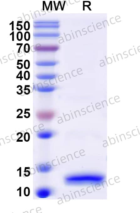 Rat PTH1R Recombinant Protein (N-His)