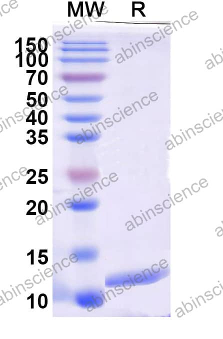 Rat S100B Recombinant Protein (N-His)
