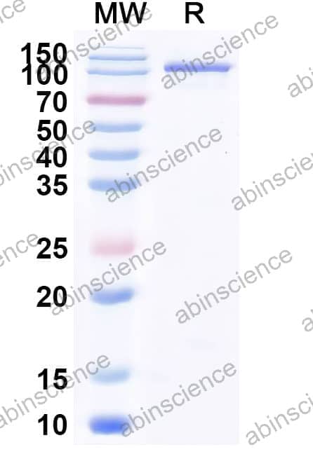 Rat HSP90AB1 Recombinant Protein (N-GST & C-His)