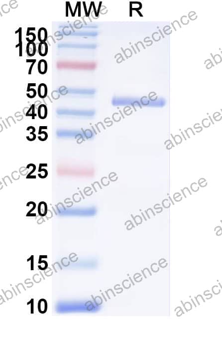 Rat GALT Recombinant Protein (N-His)