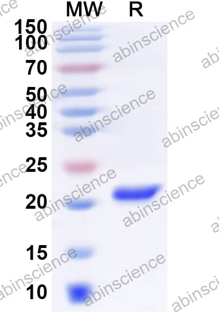Porcine IL-10 Recombinant Protein (N-His)
