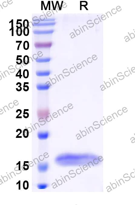 Anti-HSV Glycoprotein B/gB Nanobody (Nb1_gbHSV)