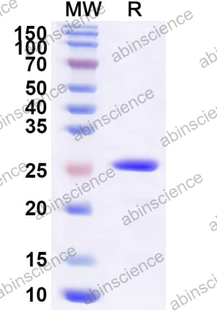 Recombinant Oropouche virus/OROV Nucleoprotein, N-His