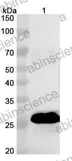 Anti-Oropouche virus/OROV Nucleoprotein Polyclonal Antibody