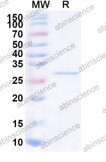 MPV15 Matrix Recombinant Protein (N-His)