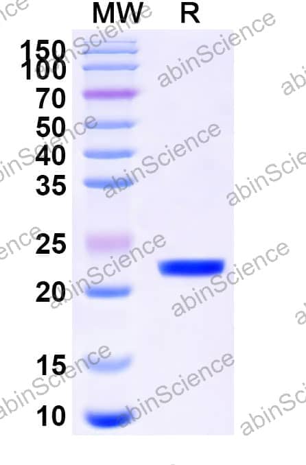 MPV15 M2-1 Recombinant Protein (N-His)