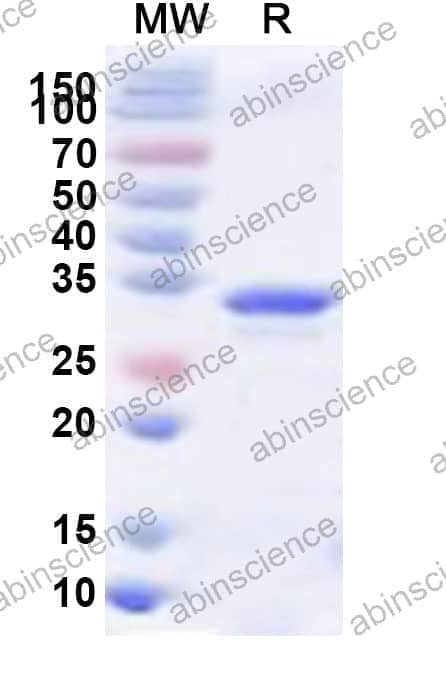 MPV15 NS1 Recombinant Protein (N-GST & C-His)