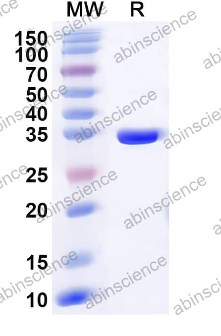 Recombinant Murine minute virus/MVM NS1 Protein, N-His