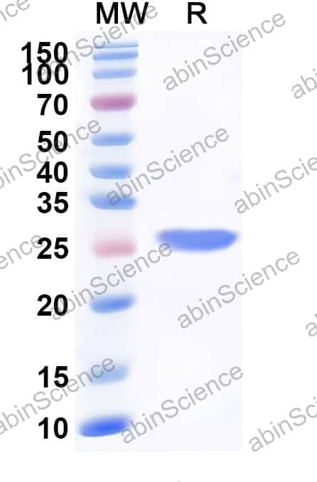 Recombinant LCMV Nucleoprotein, N-His