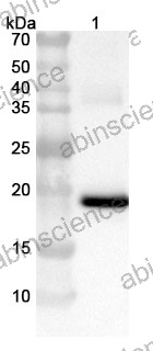 Anti-LCMV Glycoprotein GP2 Antibody