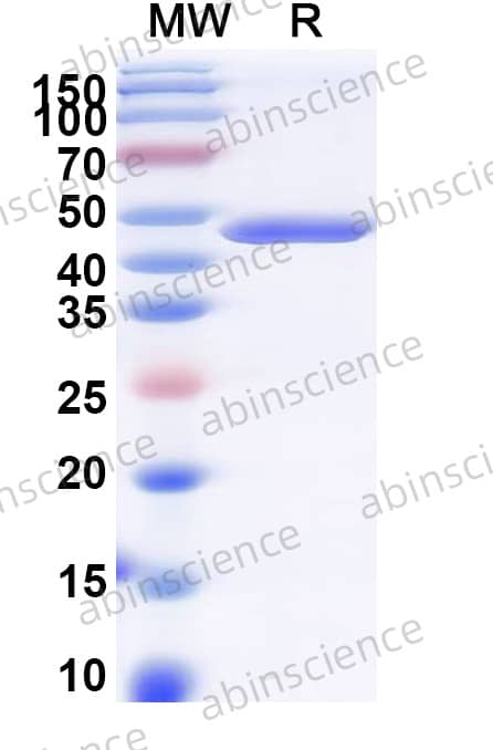 HAdV-19p E3/49K Recombinant Protein (C-His)