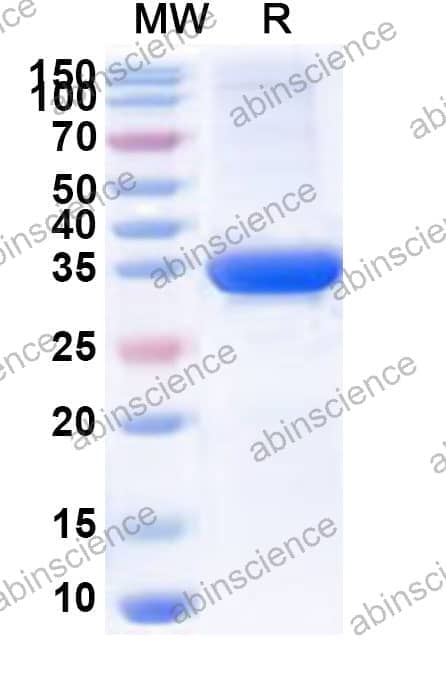 Sapporo virus NS1 Recombinant Protein (N-GST & C-His)