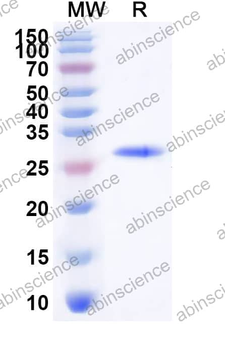 Sapporo virus NS4 Recombinant Protein (N-His)