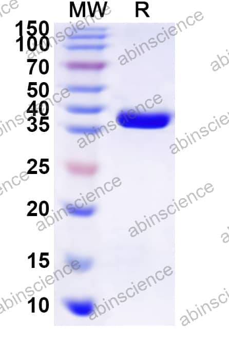 Sapporo virus VPg Recombinant Protein (N-GST & C-His)