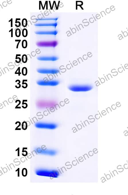 Rotavirus A VP6 Recombinant Protein (C-His)