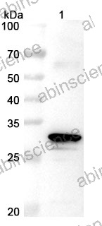 Anti-ASFV D117L Polyclonal Antibody