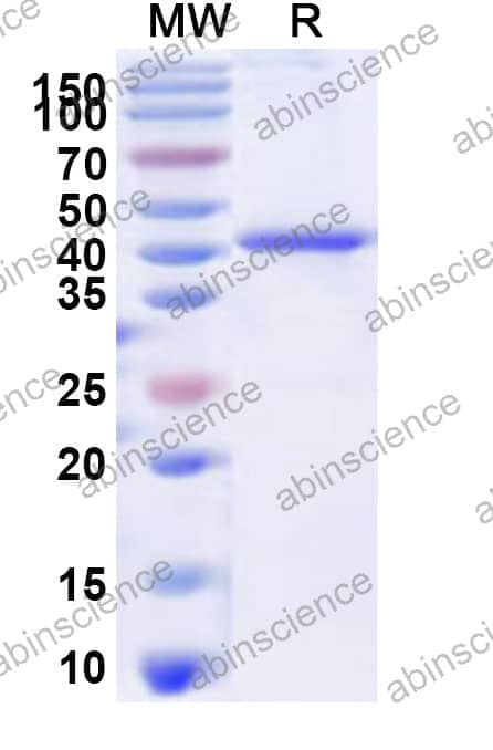 Recombinant IBV nsp3 Protein, N-His