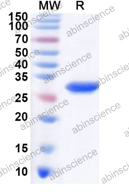 IBV 3CL Recombinant Protein (N-His)
