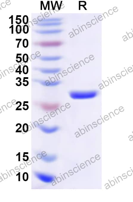 FHV-1 glycoprotein B/gB Recombinant Protein (N-His)