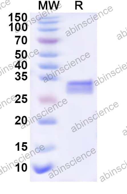 FHV-1 glycoprotein C/gC Recombinant Protein (N-His)