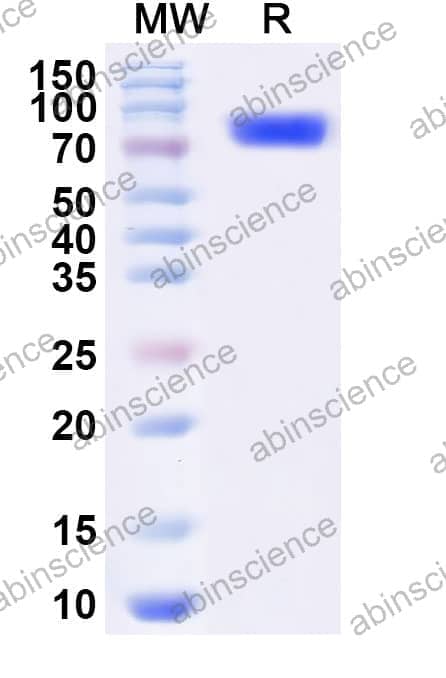 FHV-1 glycoprotein D/gD Recombinant Protein (C-Fc)