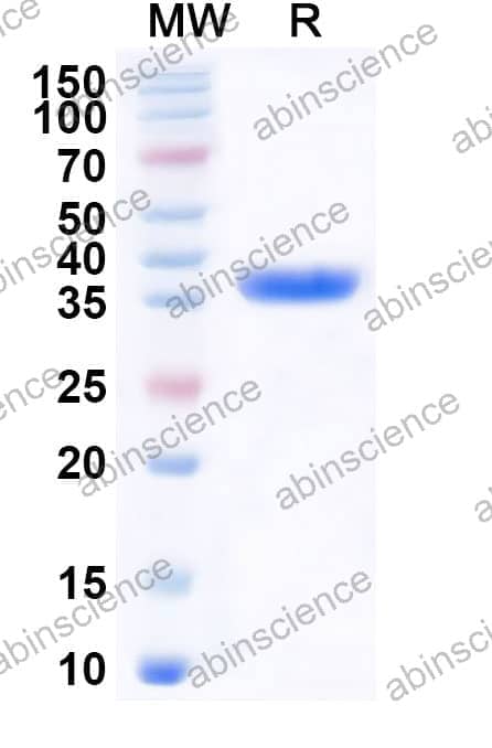 FHV-1 glycoprotein D/gD Recombinant Protein (N-His)