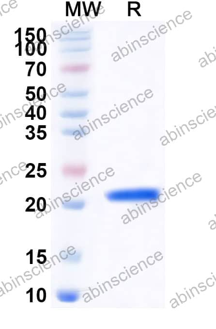 FHV-1 glycoprotein E/gE Recombinant Protein (N-His)