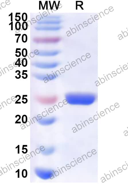 FHV-1 Capsid maturation Protease Recombinant Protein (N-His)