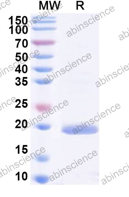 HAstV-5 Serine Protease Recombinant Protein (N-His)