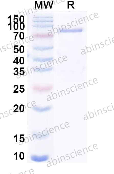 USUV Envelope E Recombinant Protein (C-Fc)