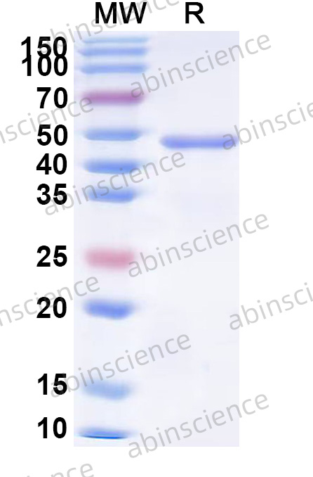 USUV Envelope E Recombinant Protein (N-His)