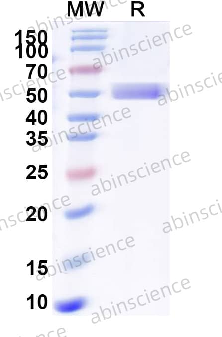 USUV Envelope E Recombinant Protein (C-His)