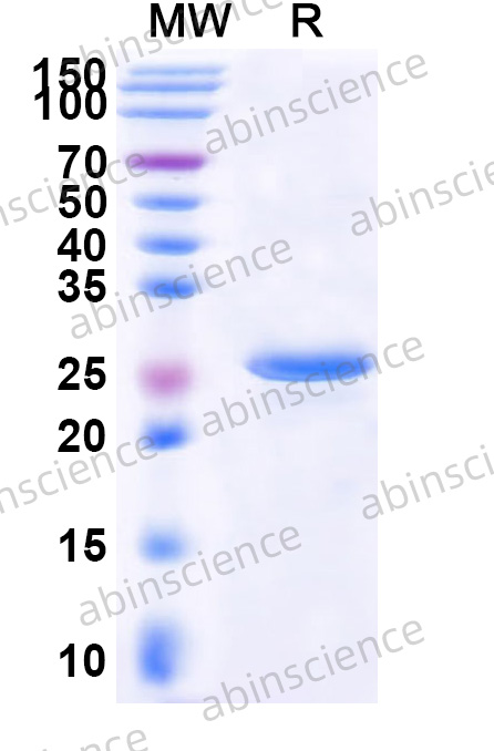 HTLV-1 Tax Recombinant Protein (N-His)