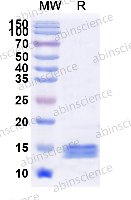 HTLV-1 Capsid p24 Recombinant Protein (N-His)