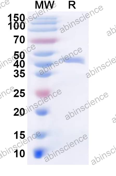 REV Envelope Glycoprotein Recombinant Protein (N-His)