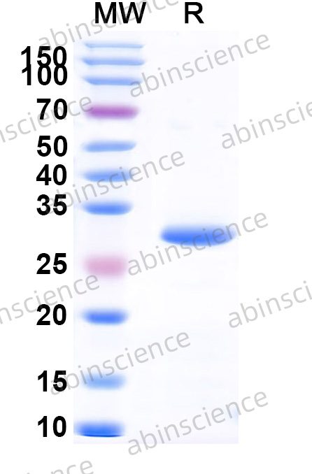 REV Capsid Recombinant Protein (N-His)